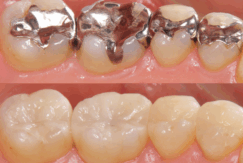 審美治療|南栗橋歯科