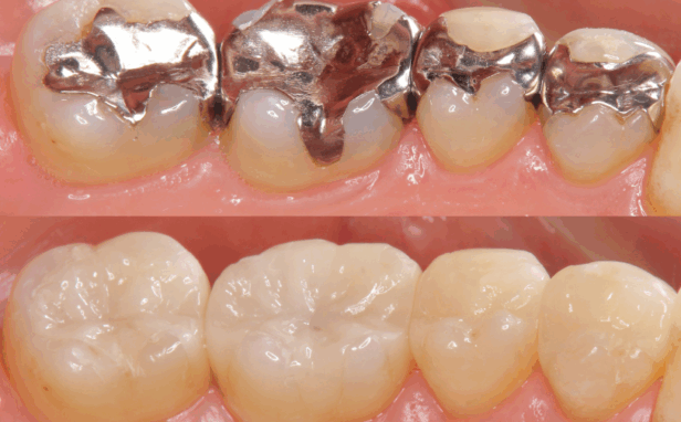 審美治療｜南栗橋歯科