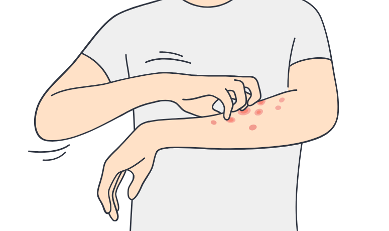 金属アレルギー|南栗橋歯科