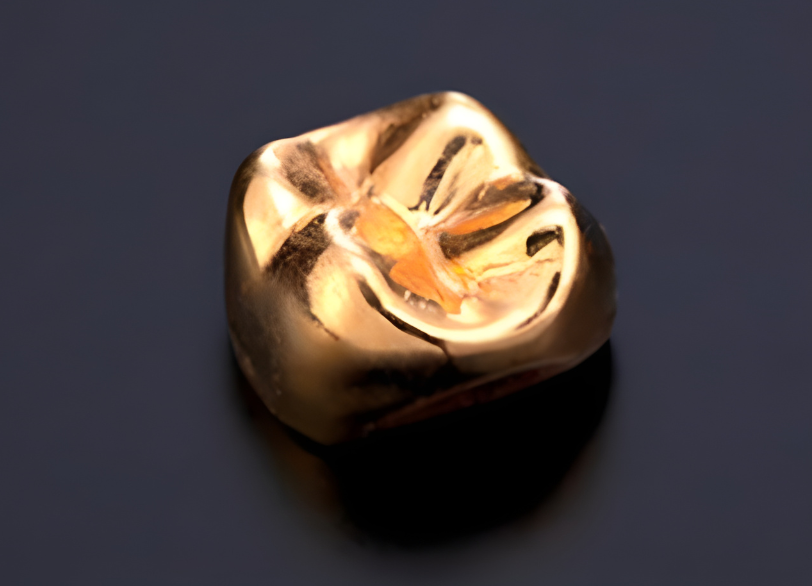 PGA(ゴールド)|南栗橋歯科