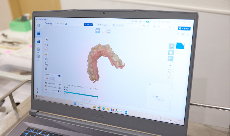 「治療のゴール」をシミュレーション|南栗橋歯科