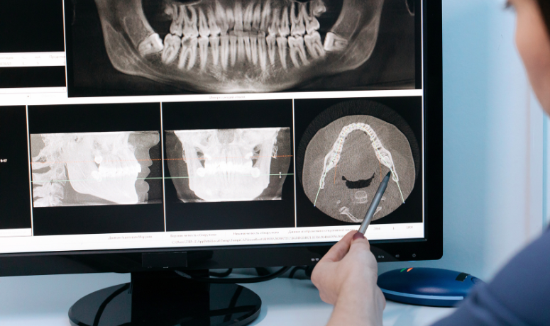 矯正専門家との連携による治療計画|南栗橋歯科