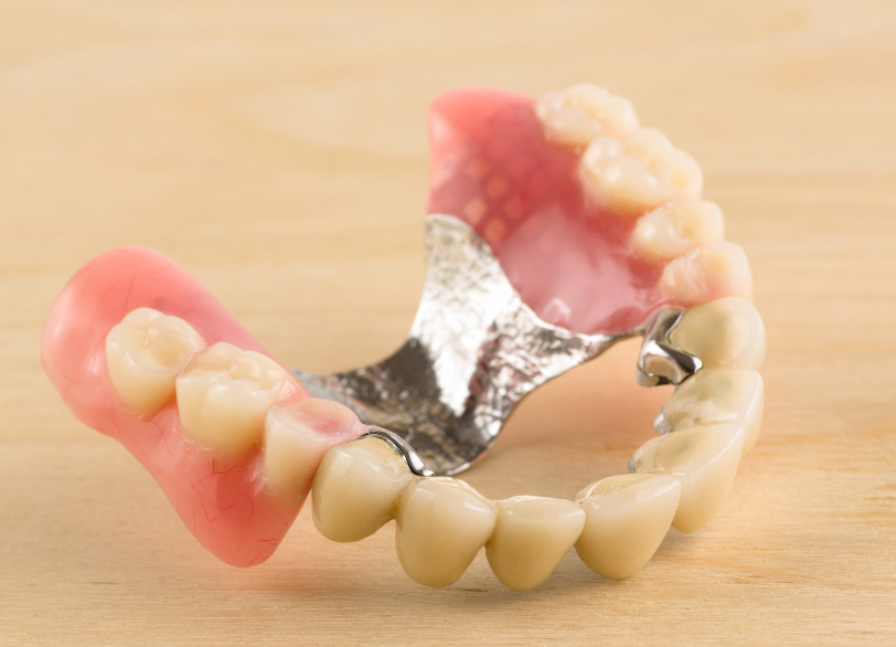 コンビネーション義歯|南栗橋歯科