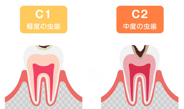 C1〜C2|南栗橋歯科
