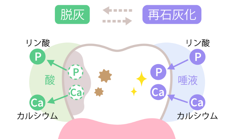 再石灰化|南栗橋歯科