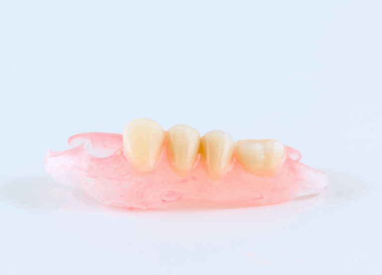 ノンクラスプデンチャー|南栗橋歯科