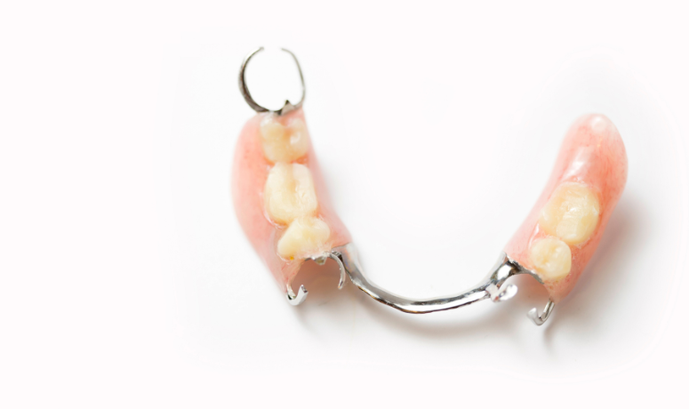 部分入れ歯|南栗橋歯科