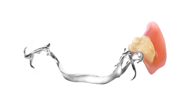 部分入れ歯|南栗橋歯科