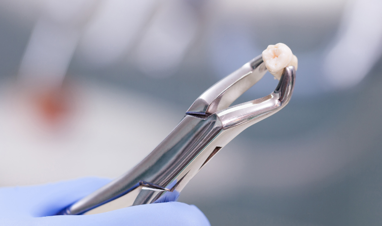 当院で対応する口腔外科治療｜南栗橋歯科