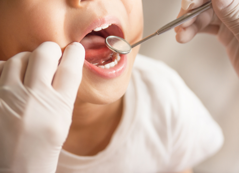 お子様の歯がデリケートな理由|南栗橋歯科