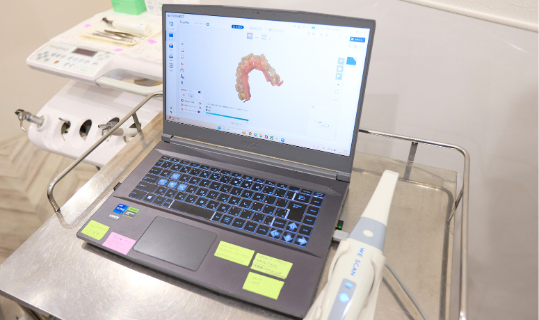 口腔内スキャナー|南栗橋歯科