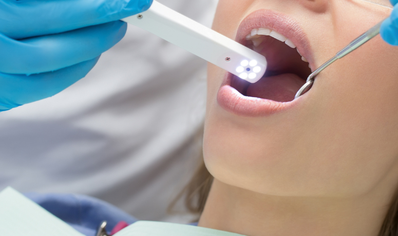 口腔内写真|南栗橋歯科