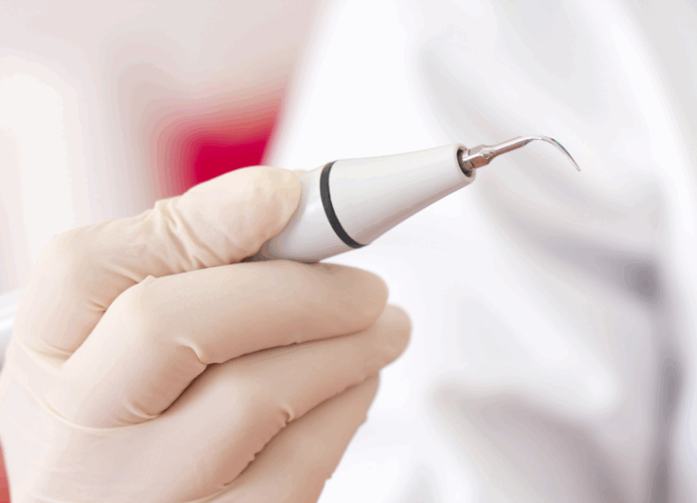 超音波スケーラー|南栗橋歯科