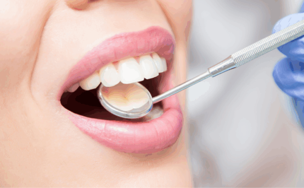 予防歯科｜南栗橋歯科