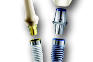 インプラントについて